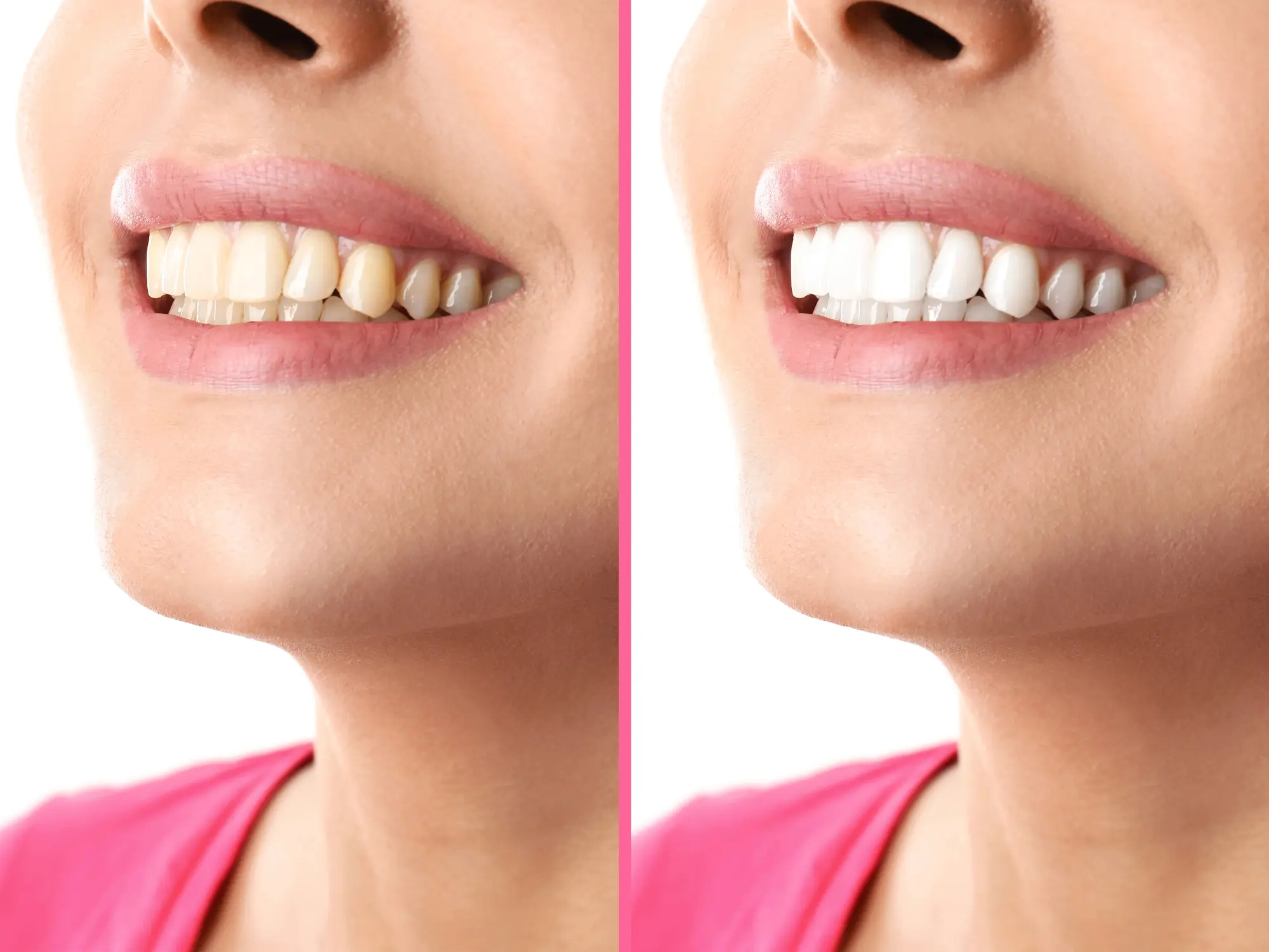 Whitening · 6 shades brighter